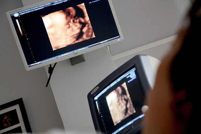 Profesjonalny monitor usg ciąży